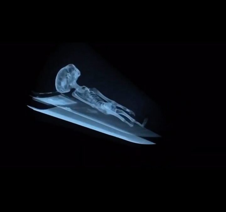 New scan of the alien from Japan UFO Briefing
